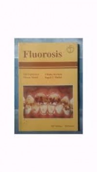 Image of Fluorosis
